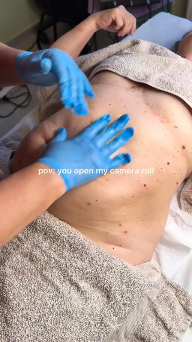 Lymph&UP