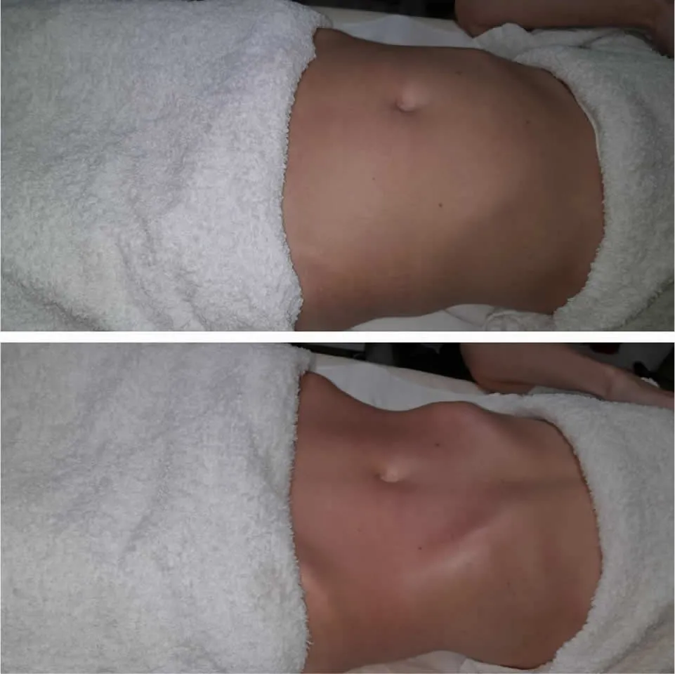 Lymph&UP