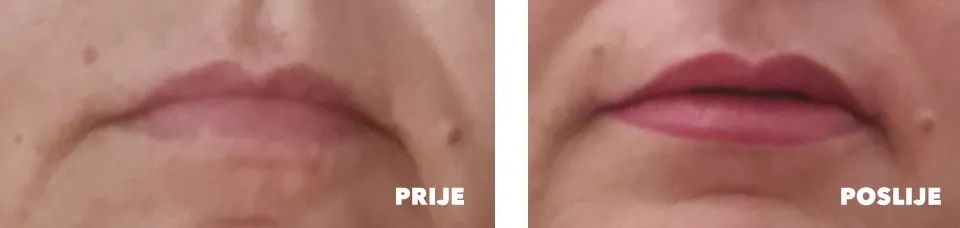 Phi Contour